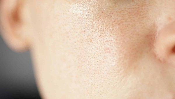 Comment diminuer l'apparence des pores avec un traitement maison?